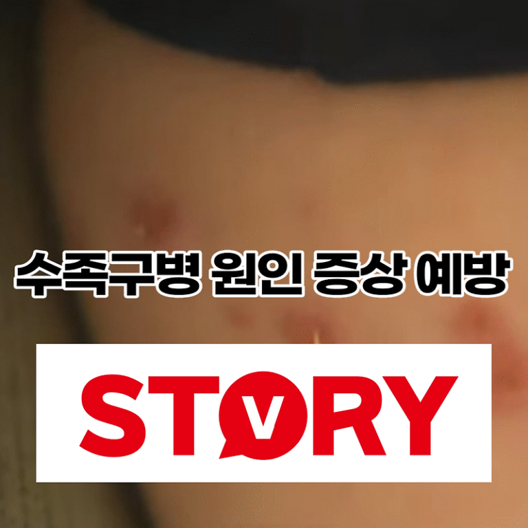 수족구병 원인 증상 예방 조치 및 치료 수족구병 유행시기 언제일까?