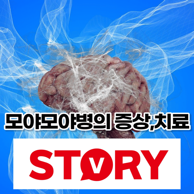 희귀병 모야모야병 원인, 증상, 검사와 진단, 치료방법 (ft : 모야모야의 어원?)