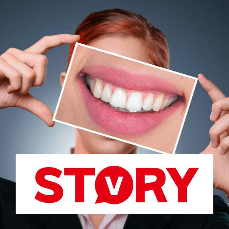 치아미백 5가지 방법 (ft : 치아미백 민간요법 베이킹소다)