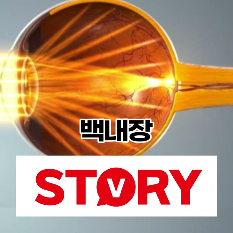 백내장이란? 원인, 증상, 백내장 수술 비용? (ft : 백내장 발병율)