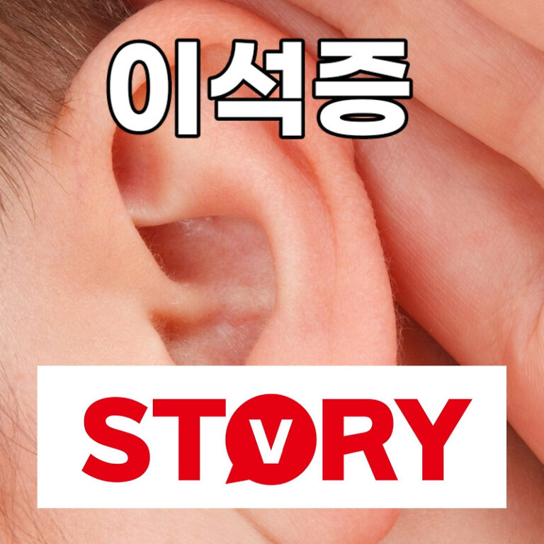 갑자기 찾아오는 이석증 자가진단법 예방
